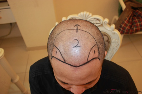 我的頭等大事在成都科發(fā)源了結(jié)了，F(xiàn)UE+PTT 2800單位案例