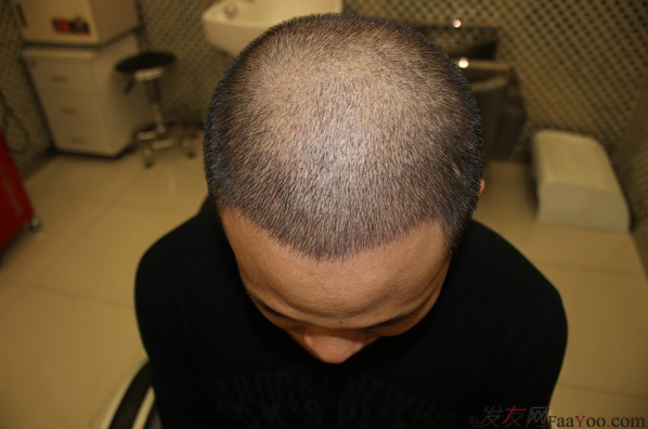 我的頭等大事在成都科發(fā)源了結(jié)了，F(xiàn)UE+PTT 2800單位案例