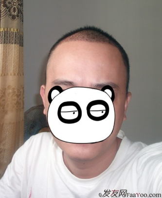 在上海植信植發(fā)歸來，分享一年來的變化