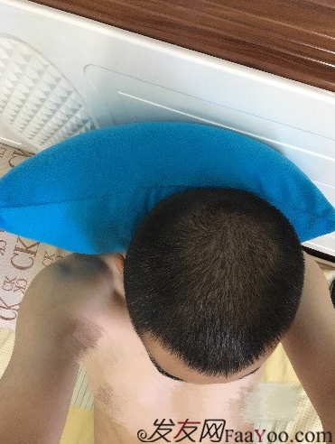 杭州大麥微針pse+fue=3884，新年一切從頭開始！