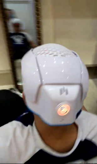 三級脫發(fā)植發(fā)，在鄭州大麥微針植發(fā)2700pse+200ptt+st&nbsp;