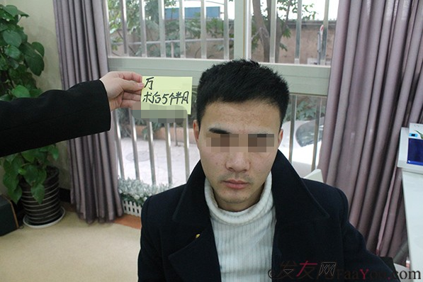 上海雍禾植發(fā)以后都說我變帥了，其實我想說感謝雍禾植發(fā)