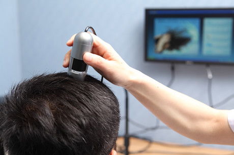 南昌植發(fā)手術(shù)需要多少費用，我在南昌植發(fā)2000個毛囊效果分享