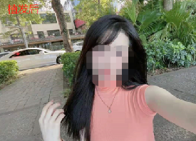 發(fā)際線植發(fā)手術(shù)2500單位，大家一起來看術(shù)后分享總結(jié)經(jīng)驗(yàn)