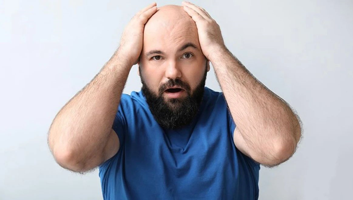 發(fā)際線高怎么辦