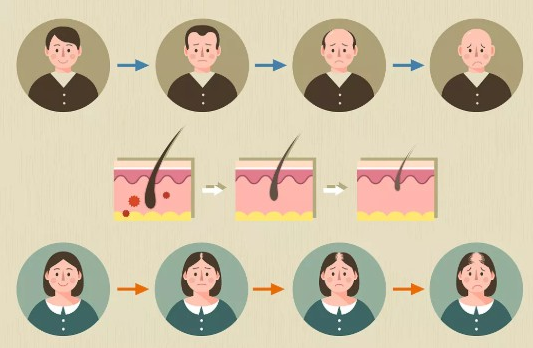 植發(fā)手術的價格貴嗎?植發(fā)手術費用大概多少錢?