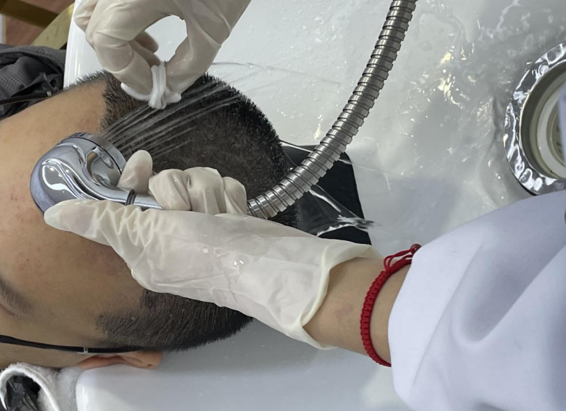 臨沂華美植發(fā)