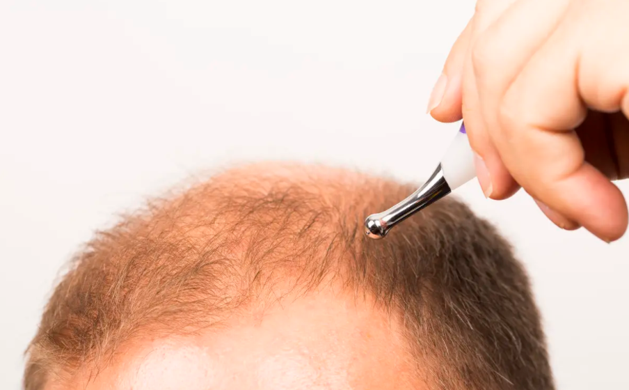 2022年鄭州十佳植發(fā)醫(yī)院名單